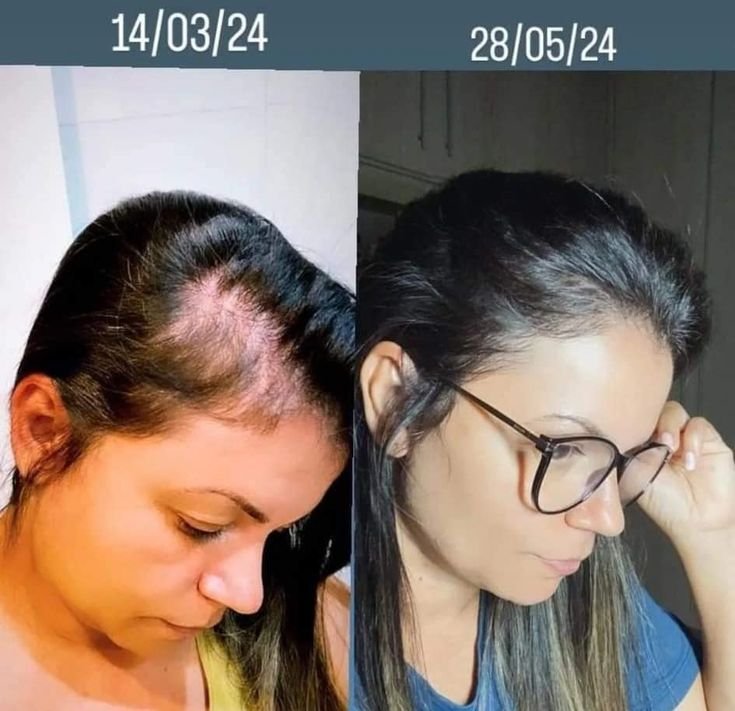 Resultado do Protocolo da Raiz Limpa